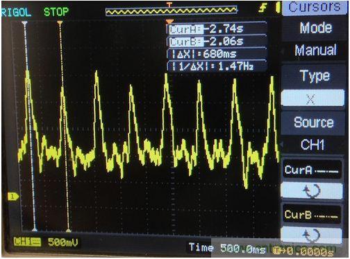 可穿戴技術在醫(yī)學領域遍地生花：脈搏血氧計問世