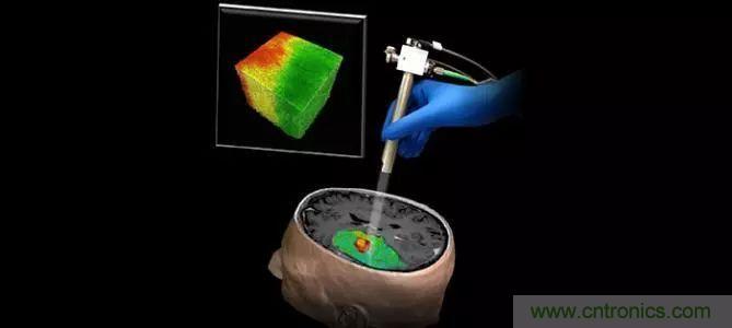 解讀光學相干層析成像技術