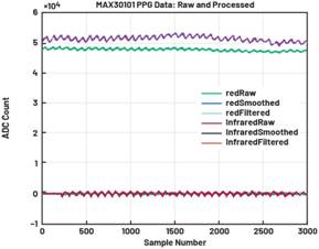 動態(tài)離散周期變換技術(shù)突破：無ECG參考的生理信號精準(zhǔn)解析